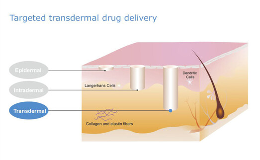 Pantec Biosolutions: Transdermal Delivery