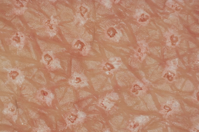 Application in Dermatology &amp; Aesthetic Medicine