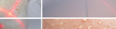 Image of medical application