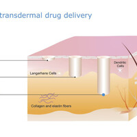 Pantec Biosolutions: Transdermal delivery